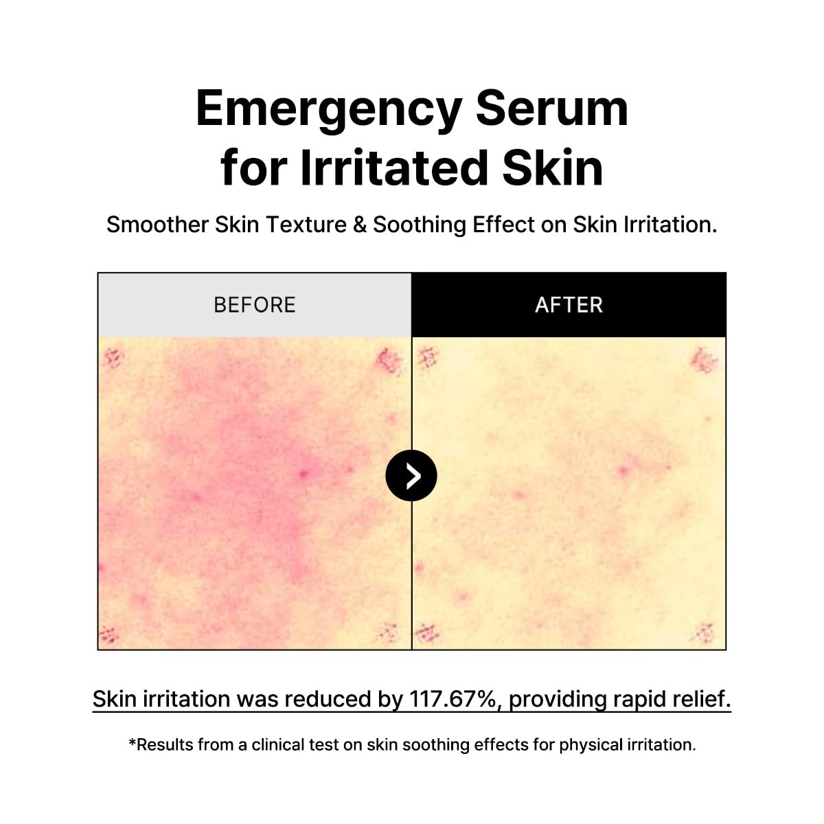 [B:Lab] Ji-chi Hydro Boost Layer Serum 30ml