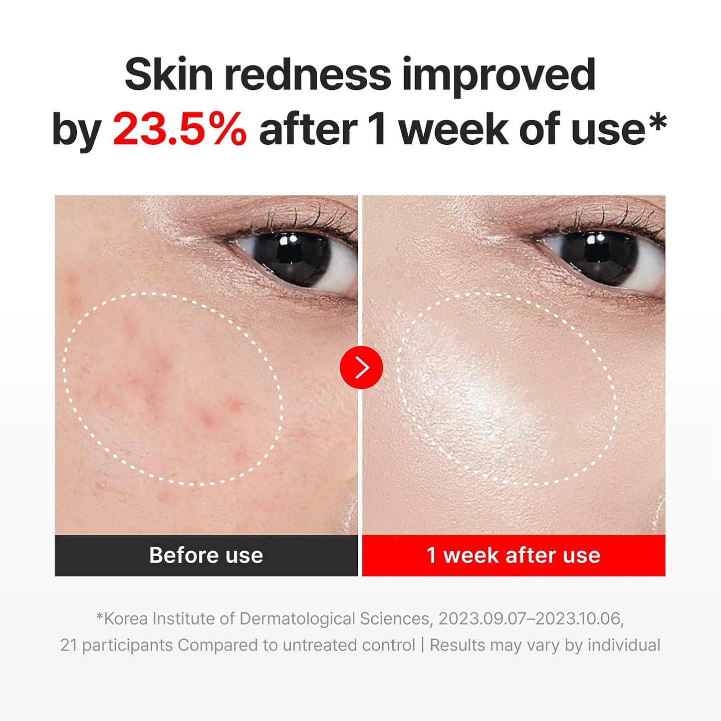 [CENTELLIAN24] Madecica Cream Time Reverse 50ml