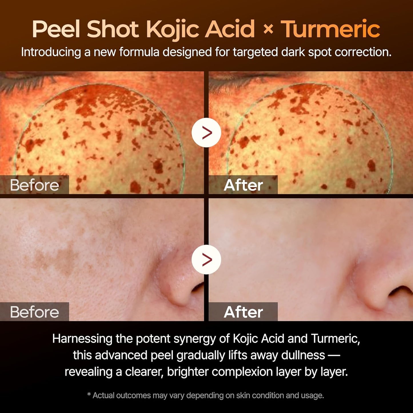 [DR.MELAXIN] Peel Shot Kojic Acid Turmenic Serum 80ml