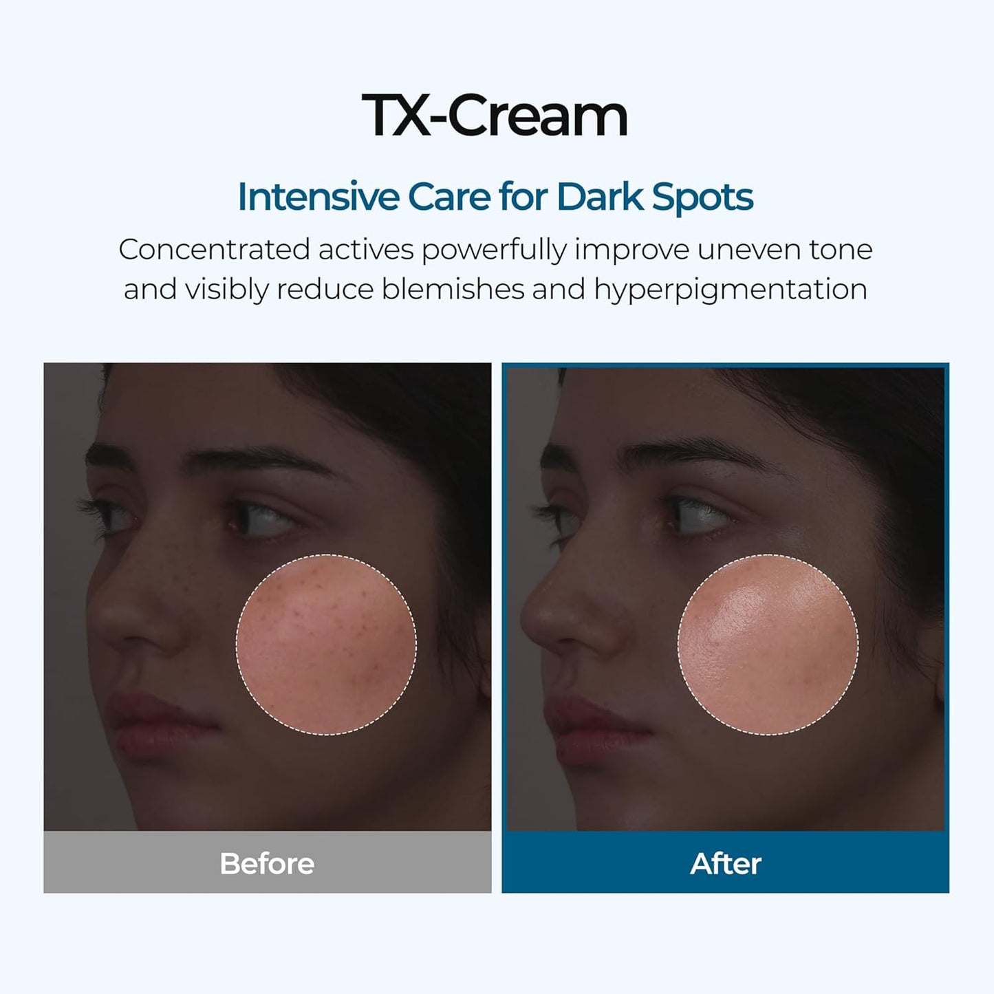 [DR.MELAXIN] TX Tranexamic Acid Cream 50ml