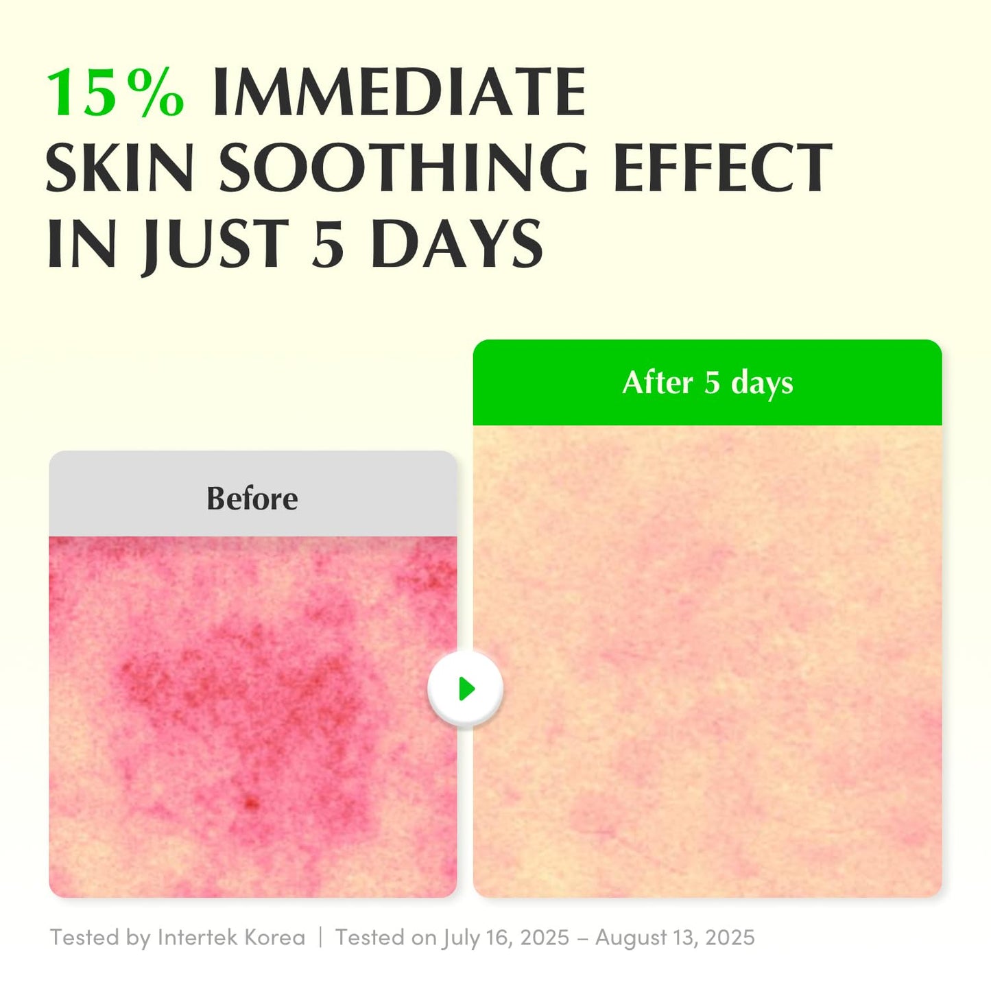 [EQQUALBERRY] ALOE PDRN CALMING SERUM 30ml/ALOEPDRN