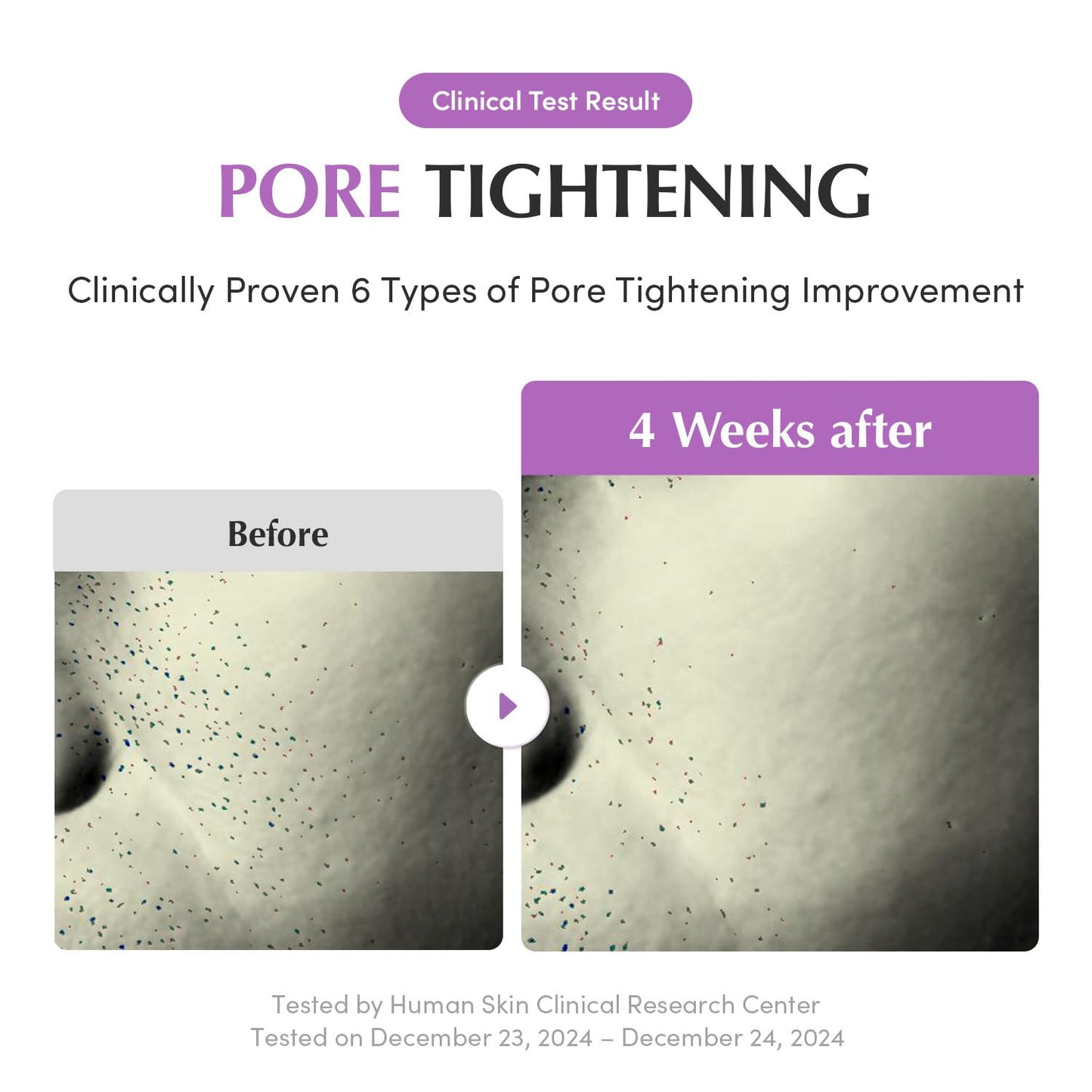 [EQQUALBERRY] Purple PDRN Pore Minimizing Serum 30ml