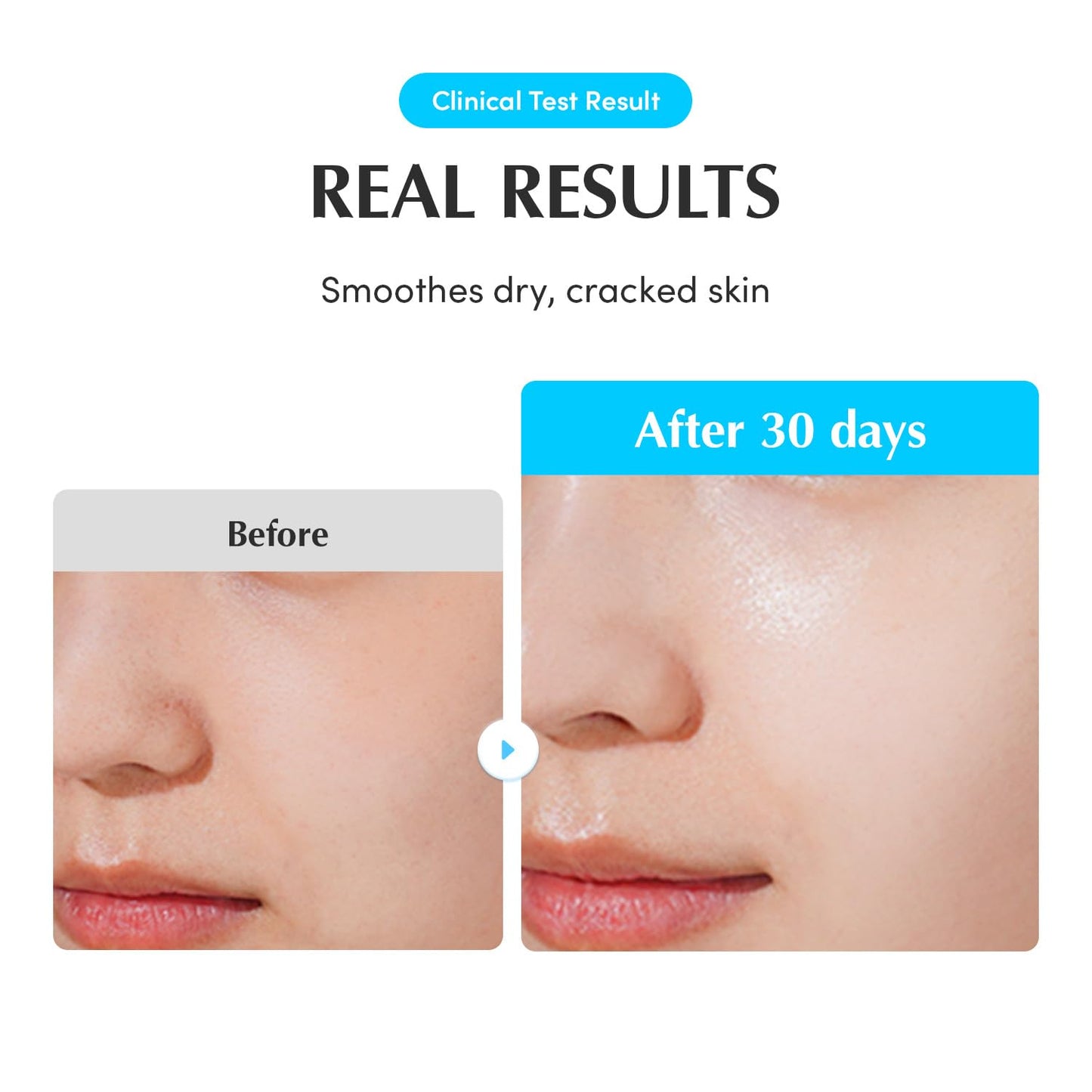 [EQQUALBERRY] Swimming Pool Ampoule 50ml