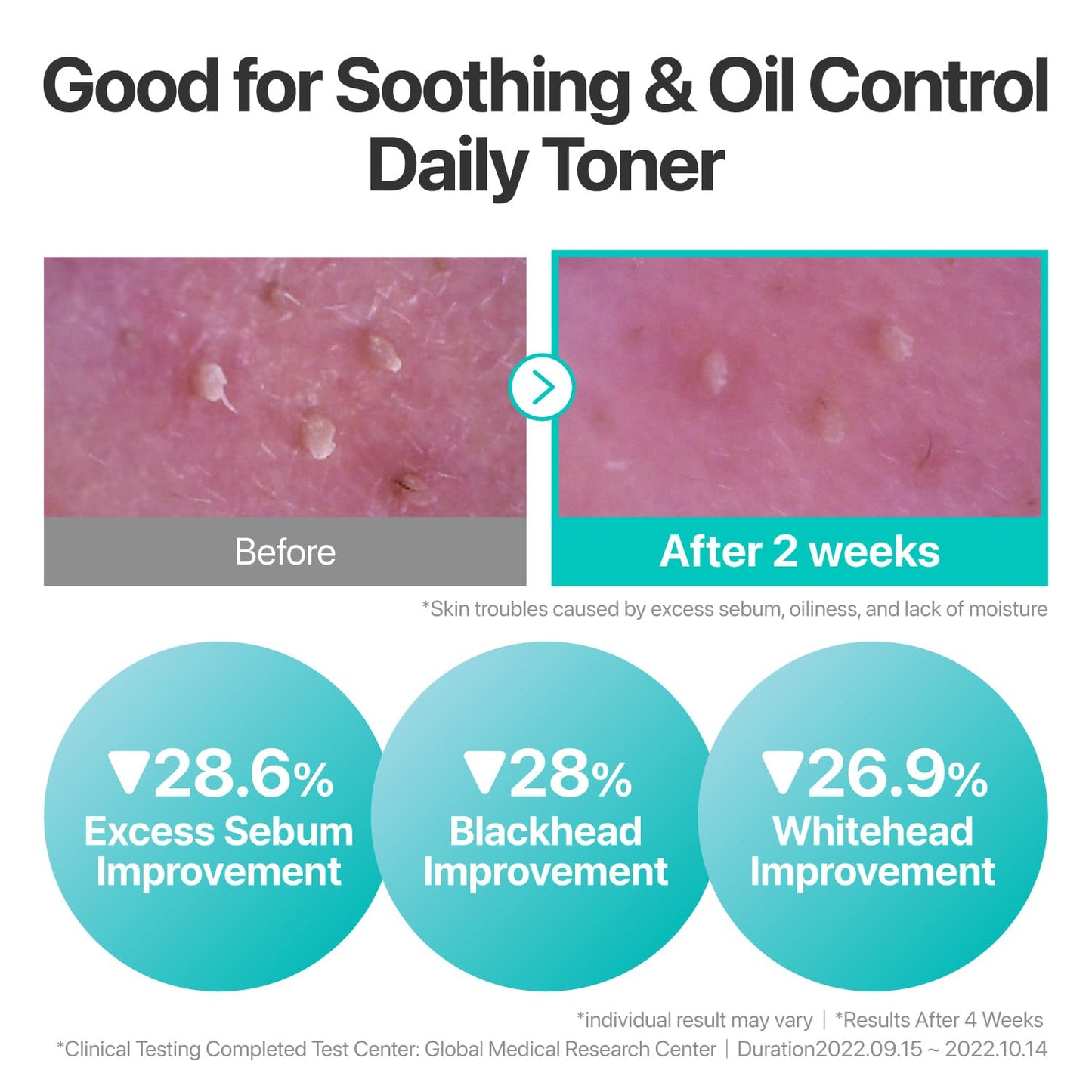 [NUMBUZIN] No.1 Pure-Full Calming Herb Toner