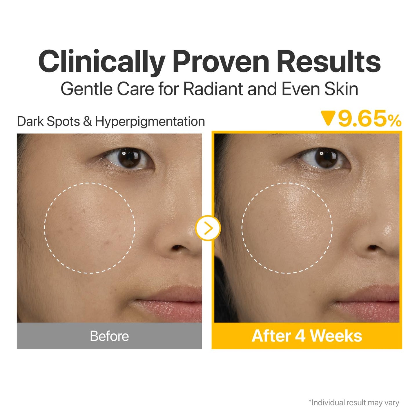 [NUMBUZIN] No.5+ Glutathione Vitamin Concentrated Serum