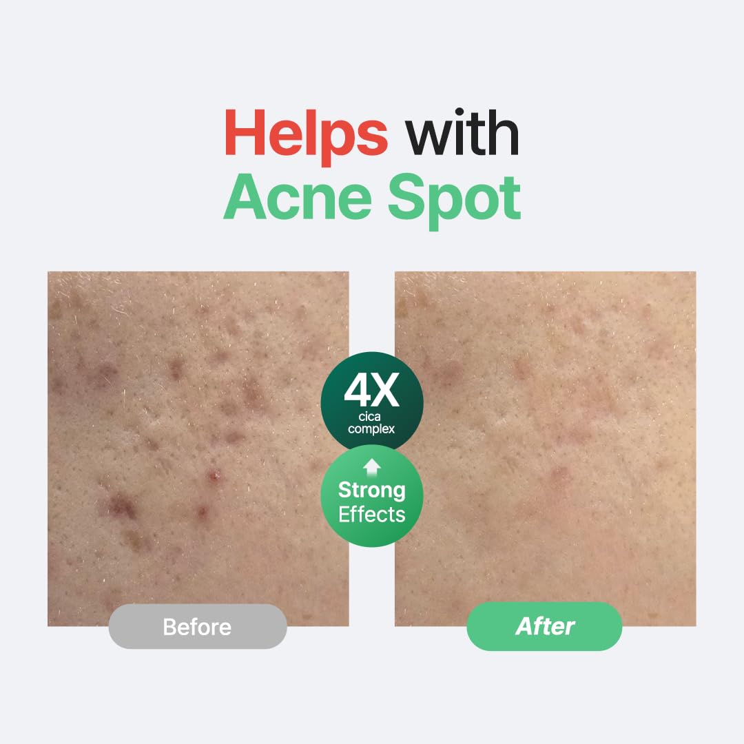 [PURITO] Wonder Releaf Centella Serum Unscented