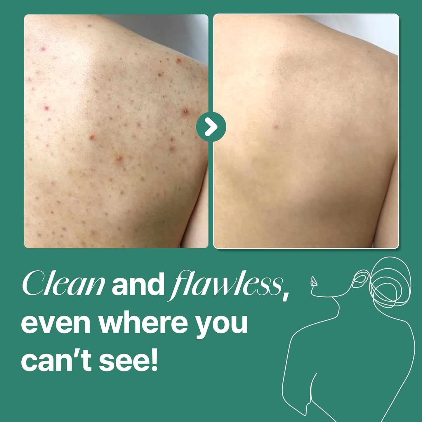 [SOME BY MI] AHA-BHA-PHA 30 DAYS MIRACLE ACNE CLEAR BODY CLEANSER 400g