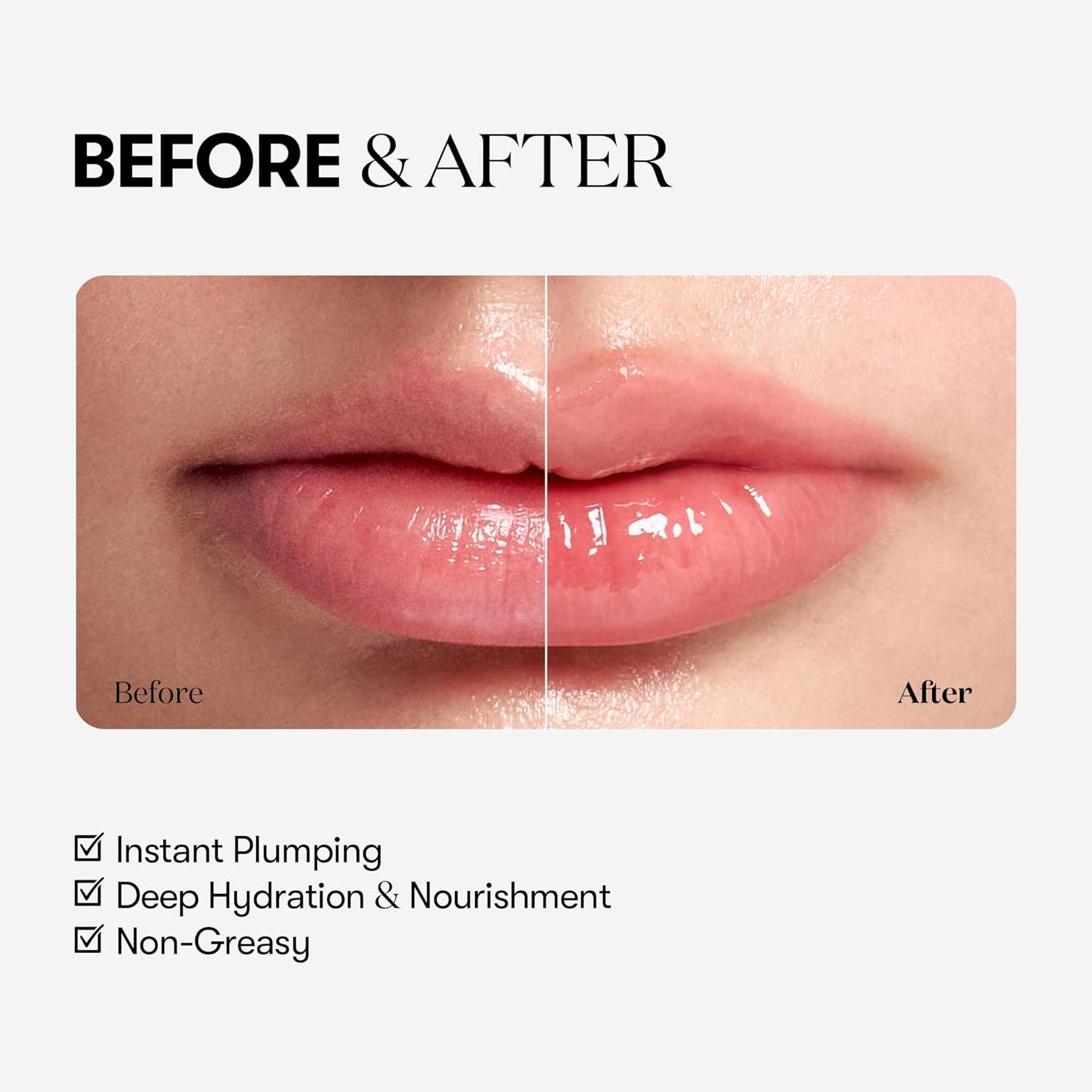 [VT] REEDLE SHOT LIP PLUMPER EXPERT